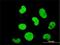 Zinc Finger Protein 207 antibody, H00007756-M03, Novus Biologicals, Immunofluorescence image 