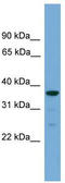 Hyaluronan and proteoglycan link protein 2 antibody, TA344718, Origene, Western Blot image 