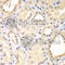 Spindlin Family Member 2B antibody, A7407, ABclonal Technology, Immunohistochemistry paraffin image 