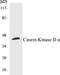 Casein Kinase 2 Alpha 1 antibody, EKC1082, Boster Biological Technology, Western Blot image 