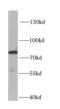 Hydroxyacyl-CoA Dehydrogenase Trifunctional Multienzyme Complex Subunit Alpha antibody, FNab03748, FineTest, Western Blot image 