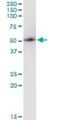 Armadillo Repeat Containing 6 antibody, H00093436-M03, Novus Biologicals, Immunoprecipitation image 