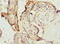 Bisphosphoglycerate Mutase antibody, LS-C675430, Lifespan Biosciences, Immunohistochemistry paraffin image 