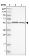 Leucine Zipper And EF-Hand Containing Transmembrane Protein 2 antibody, NBP1-83563, Novus Biologicals, Western Blot image 
