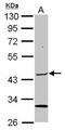 Elongator Acetyltransferase Complex Subunit 4 antibody, GTX111748, GeneTex, Western Blot image 