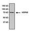 Heat Shock Protein Family A (Hsp70) Member 9 antibody, MA1-094, Invitrogen Antibodies, Immunoprecipitation image 