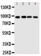 SID1 Transmembrane Family Member 1 antibody, PA2113, Boster Biological Technology, Western Blot image 