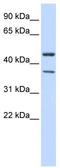 Potassium Voltage-Gated Channel Subfamily J Member 4 antibody, TA338549, Origene, Western Blot image 