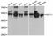 Septin 11 antibody, LS-C747355, Lifespan Biosciences, Western Blot image 