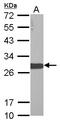 Protein lin-28 homolog A antibody, GTX121923, GeneTex, Western Blot image 