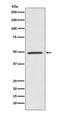 Bone Morphogenetic Protein 7 antibody, M00858, Boster Biological Technology, Western Blot image 