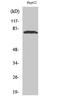 Adenosine Deaminase RNA Specific B1 antibody, STJ91484, St John