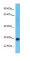 Small Nuclear Ribonucleoprotein Polypeptides B And B1 antibody, orb327279, Biorbyt, Western Blot image 