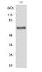 Inter-alpha-trypsin inhibitor heavy chain H2 antibody, A07196, Boster Biological Technology, Western Blot image 