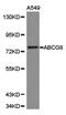 ATP Binding Cassette Subfamily G Member 8 antibody, PA5-76088, Invitrogen Antibodies, Western Blot image 