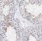Outer Dense Fiber Of Sperm Tails 2 antibody, NBP1-85417, Novus Biologicals, Immunohistochemistry frozen image 