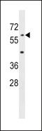 Acyloxyacyl Hydrolase antibody, 59-116, ProSci, Western Blot image 
