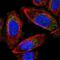 Mitochondrial Ribosomal Protein S24 antibody, NBP1-92140, Novus Biologicals, Immunocytochemistry image 
