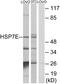 Heat Shock Protein Family A (Hsp70) Member 14 antibody, A09630, Boster Biological Technology, Western Blot image 