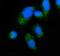 5'-Aminolevulinate Synthase 2 antibody, A02525-1, Boster Biological Technology, Immunofluorescence image 