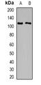 Transient Receptor Potential Cation Channel Subfamily C Member 4 antibody, abx141528, Abbexa, Western Blot image 