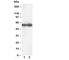 DNA nucleotidylexotransferase antibody, R30329, NSJ Bioreagents, Western Blot image 