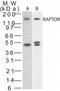 Regulatory Associated Protein Of MTOR Complex 1 antibody, TA337071, Origene, Western Blot image 