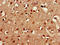 Uncharacterized protein CXorf1 antibody, LS-C396279, Lifespan Biosciences, Immunohistochemistry paraffin image 