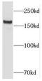 RB1 Inducible Coiled-Coil 1 antibody, FNab07146, FineTest, Western Blot image 