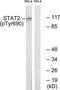 Signal Transducer And Activator Of Transcription 2 antibody, TA312889, Origene, Western Blot image 