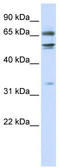 Mediator Complex Subunit 26 antibody, TA343488, Origene, Western Blot image 