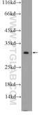 Cytochrome C Oxidase Subunit 7C antibody, 11411-2-AP, Proteintech Group, Western Blot image 
