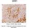 Insulin Like Growth Factor 2 MRNA Binding Protein 1 antibody, 29-384, ProSci, Enzyme Linked Immunosorbent Assay image 