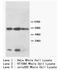 Keratin, type II cytoskeletal 8 antibody, AP23293PU-N, Origene, Western Blot image 