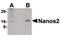 Nanos C2HC-Type Zinc Finger 2 antibody, PA5-20536, Invitrogen Antibodies, Western Blot image 