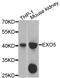 Exonuclease 5 antibody, STJ110805, St John