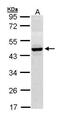 4-Hydroxyphenylpyruvate Dioxygenase antibody, PA5-27980, Invitrogen Antibodies, Western Blot image 