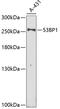 Tumor Protein P53 Binding Protein 1 antibody, 19-839, ProSci, Western Blot image 