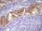 Phosphatidate phosphatase LPIN3 antibody, M10716, Boster Biological Technology, Immunohistochemistry paraffin image 