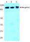 Minichromosome Maintenance Complex Component 4 antibody, A02301S54, Boster Biological Technology, Western Blot image 