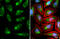 ATP Binding Cassette Subfamily D Member 3 antibody, GTX132932, GeneTex, Immunocytochemistry image 