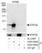 STAT5A antibody, A303-494A, Bethyl Labs, Immunoprecipitation image 