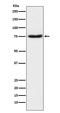 Netrin 1 antibody, M04892, Boster Biological Technology, Western Blot image 