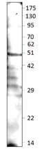 DEK Proto-Oncogene antibody, GTX47896, GeneTex, Western Blot image 