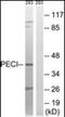 Enoyl-CoA Delta Isomerase 2 antibody, orb96600, Biorbyt, Western Blot image 