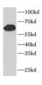 Cerebellar Degeneration Related Protein 2 antibody, FNab01568, FineTest, Western Blot image 
