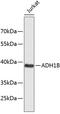 Alcohol Dehydrogenase 1B (Class I), Beta Polypeptide antibody, 15-633, ProSci, Western Blot image 