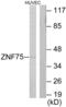 Zinc Finger Protein 75D antibody, abx013519, Abbexa, Western Blot image 