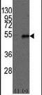 Dysbindin-1 antibody, PA5-12283, Invitrogen Antibodies, Western Blot image 