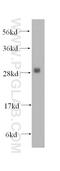 Phosphomannomutase 1 antibody, 11252-2-AP, Proteintech Group, Western Blot image 